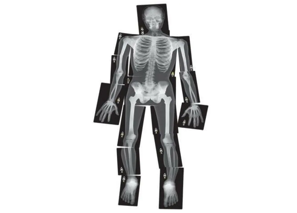 Røntgenbilleder - Menneske, 18 stk| Lysborde|Halloween
